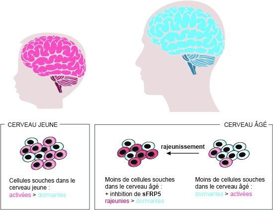 Cerveau en phase âgée