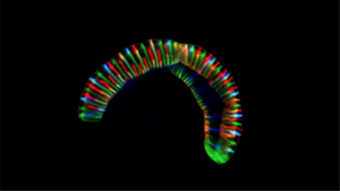 Confocal microscope image of the caterpillar-like bacterium Conchiformibius steedae, up to 7 µm long, incubated with fluorescently labelled cell wall precursors to follow its cell growth (CC BY 4.0 Philipp Weber and Silvia Bulgheresi).
