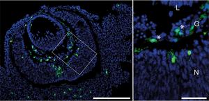 A representative section from a developing eye of a mouse