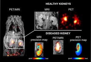 Current PET/MRI imaging of healthy and damaged mouse kidneys using the dual contrast agent [18F][Gd(FL1)].