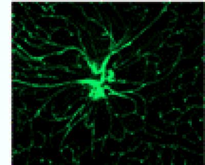 Retina from Diabetic Rats
