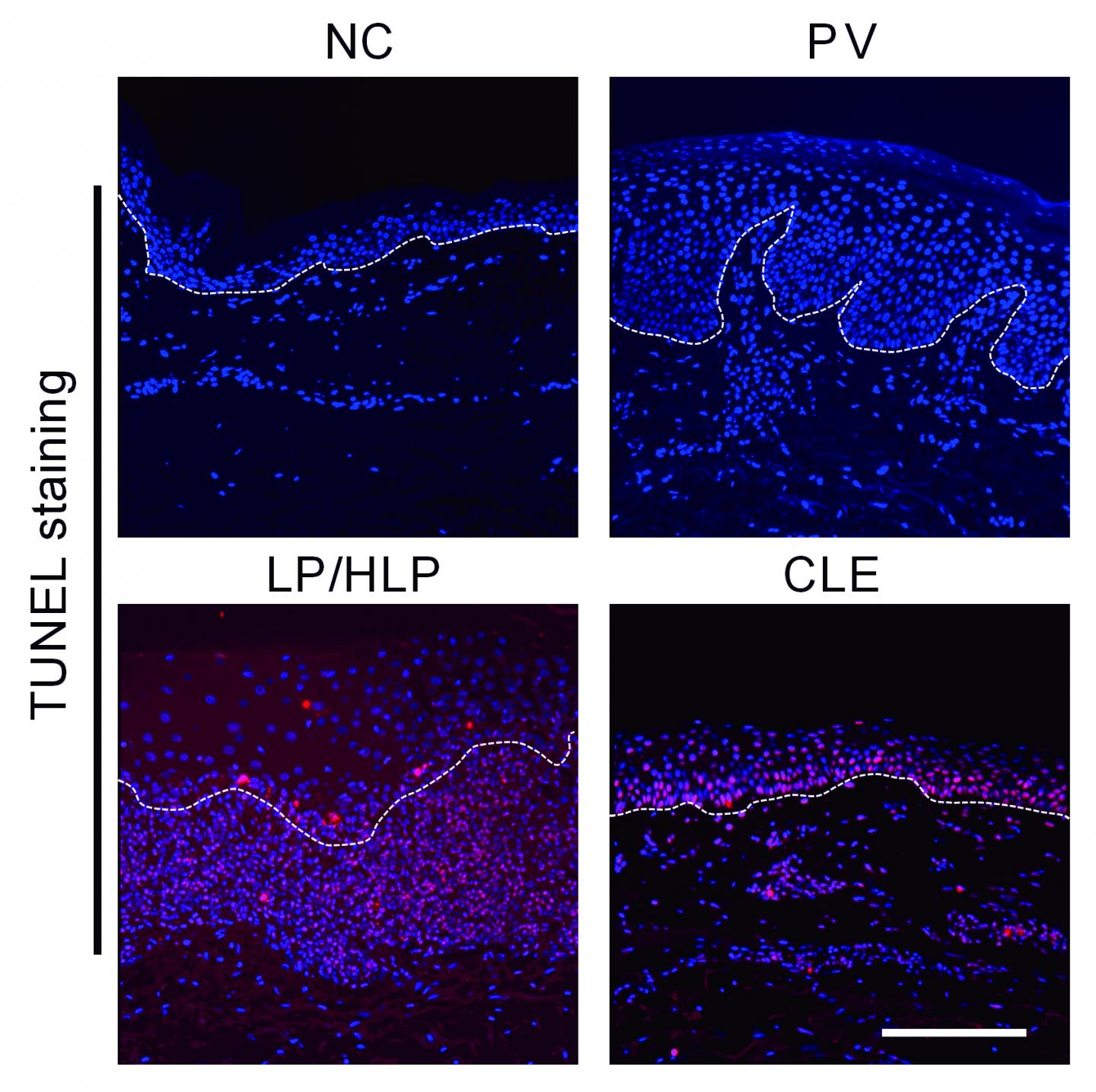 Saving Skin Cells from an Inflammatory Skin Condition (1 of 1)