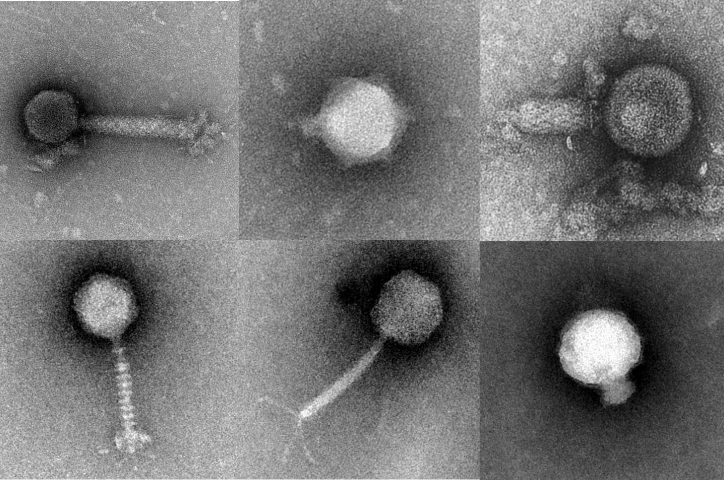 Virus Micrographs