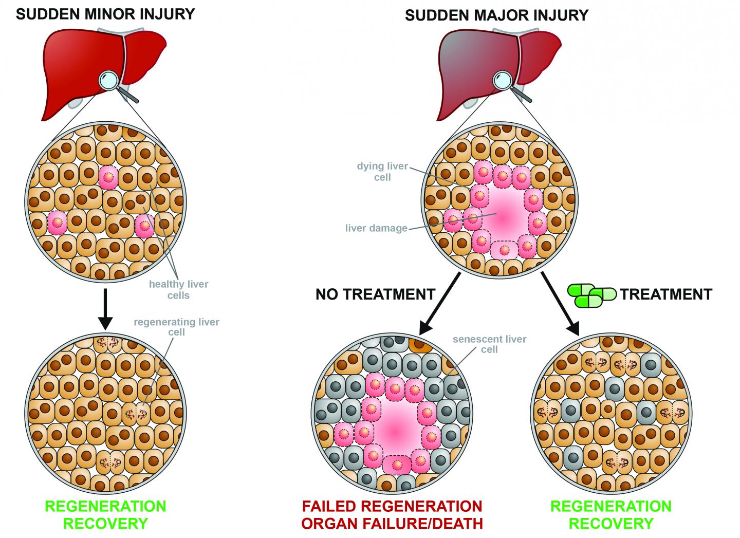 Small Molecule Restores Liver Regeneration Af EurekAlert!