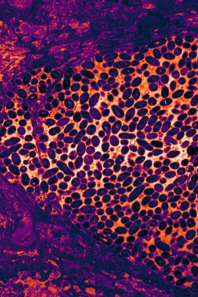False-Colored Transmission Electron Micrograph of <i>Streptococcus sanguinis</i> Cells