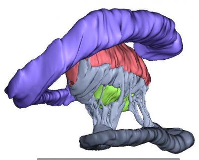 A 3-D Reconstruction of a Developing Fly Optic Lobe