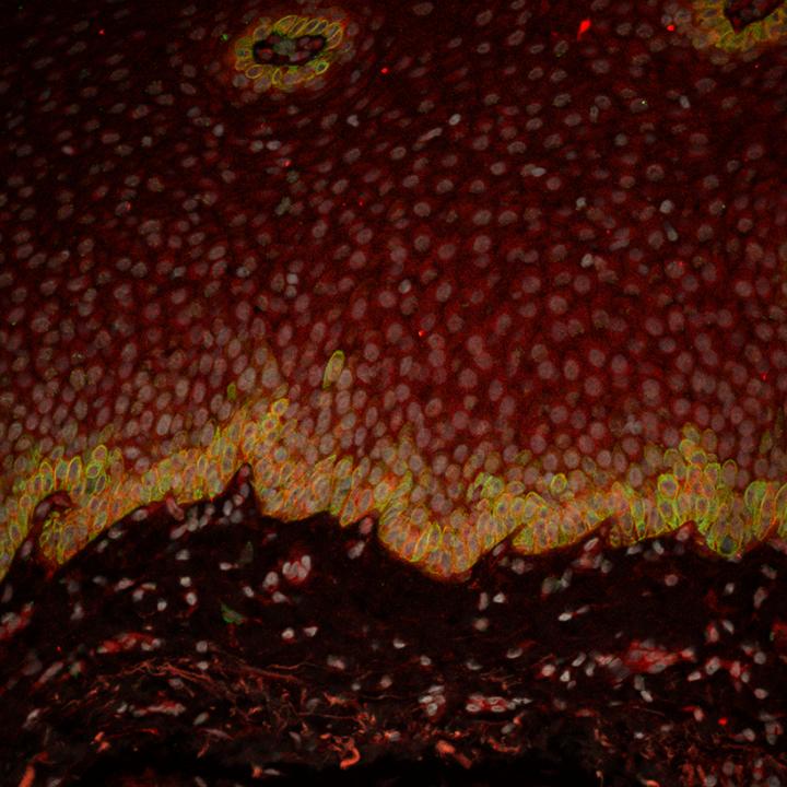 Esophageal basal cell layer