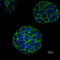 3-D Printed Hela Cell Tumors