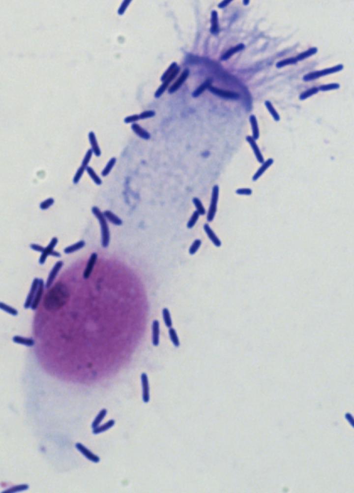 Pneumococci Sticking to a Nasal Cells
