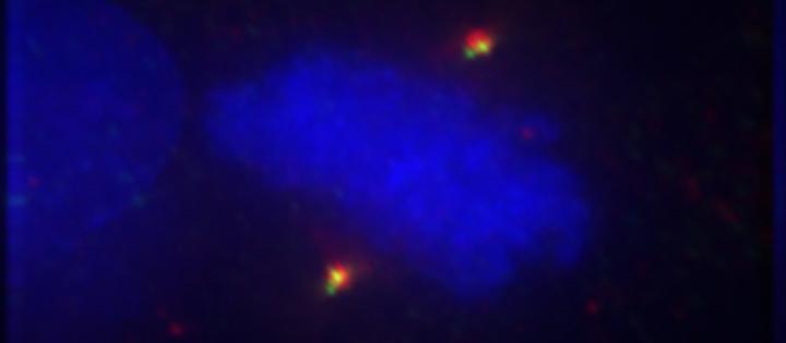 Multipolar Melanoma Cells