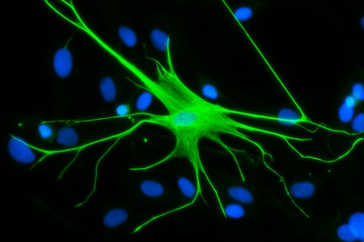 Astrocytes