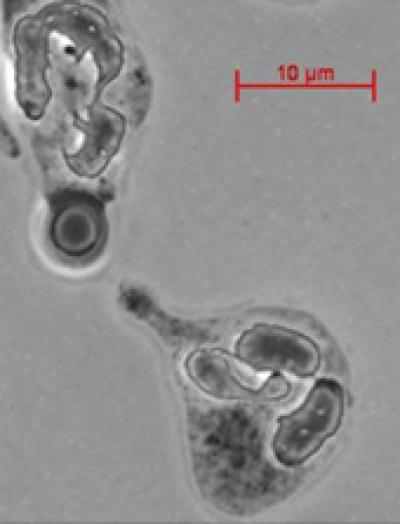 <i>Cryptococcus neoformans</i> Cell