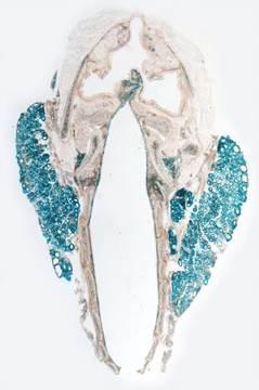 VEGF-A (Blue) in Follicular Cells of the Thyroid