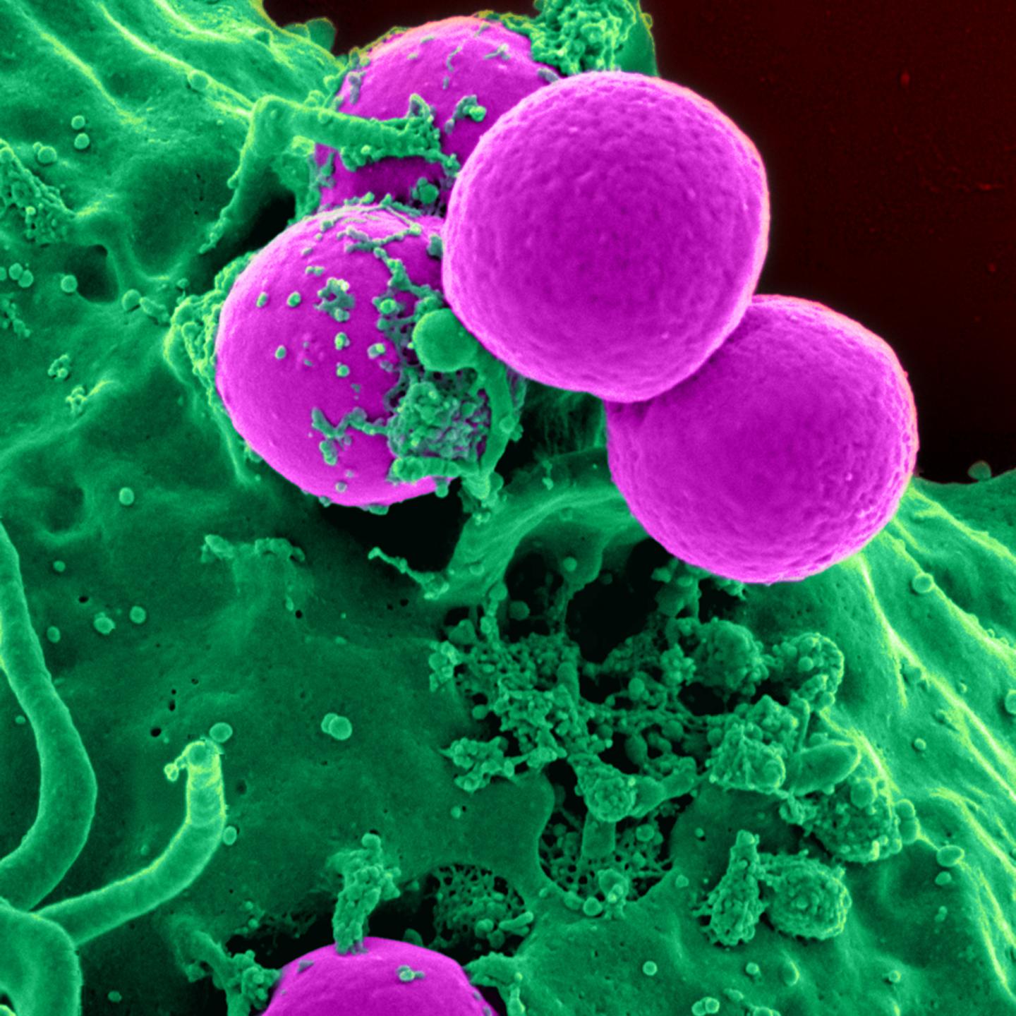 Antibiotic-Resistant Bacteria Are Responsible for a Global Health Crisis