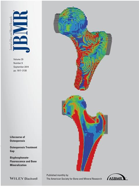 Cover of Journal of Bone and Mineral Research