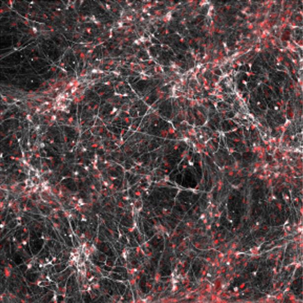 Salk Study Shows How Bipolar Disorder Affects Neurons in the Brain