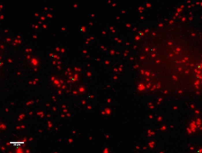 <i>Staphylococcus aureus</i>
