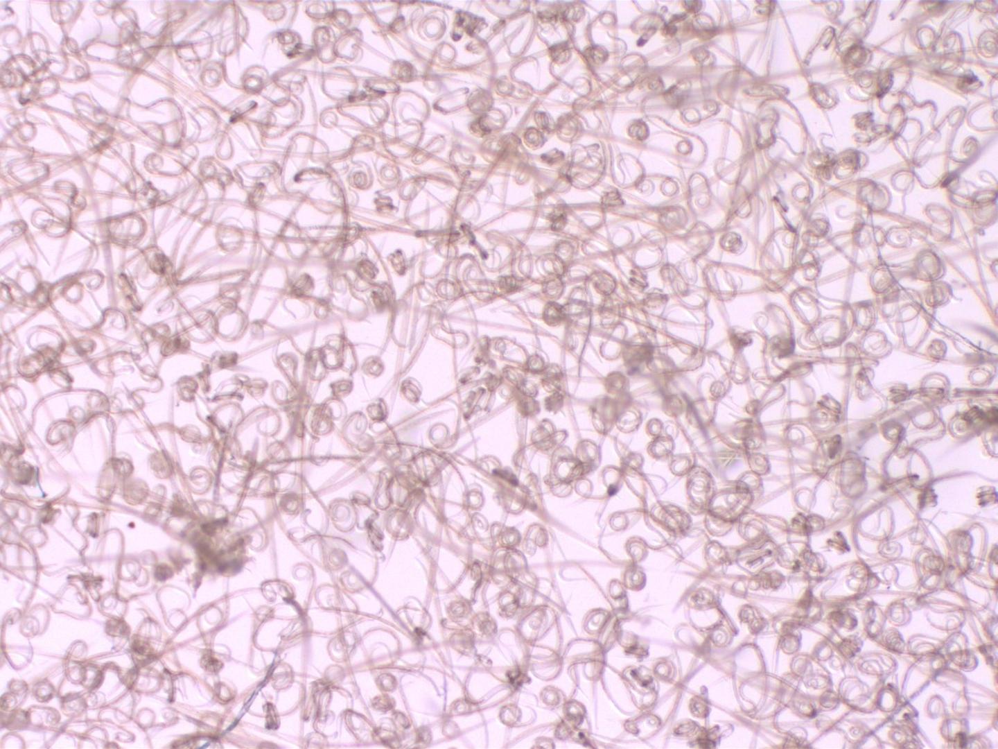 Impact Of Climate Change On Parasite Infections Depends On Host Immunity