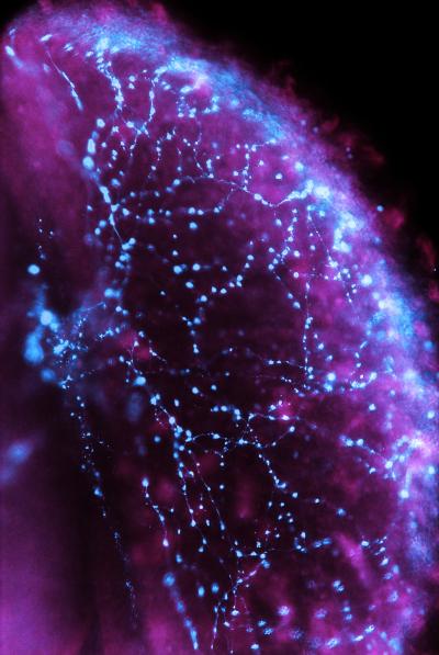 Blue-Light Sensing Arousal Neurons
