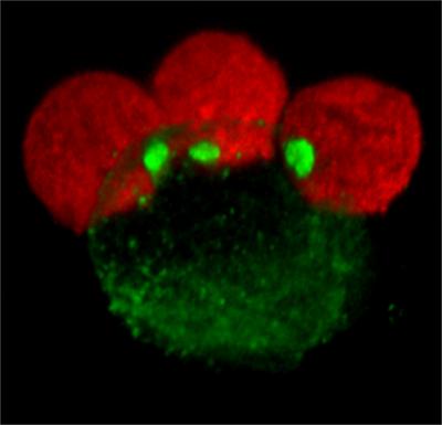 Watching HIV Jump from Cell to Cell (6 of 6)