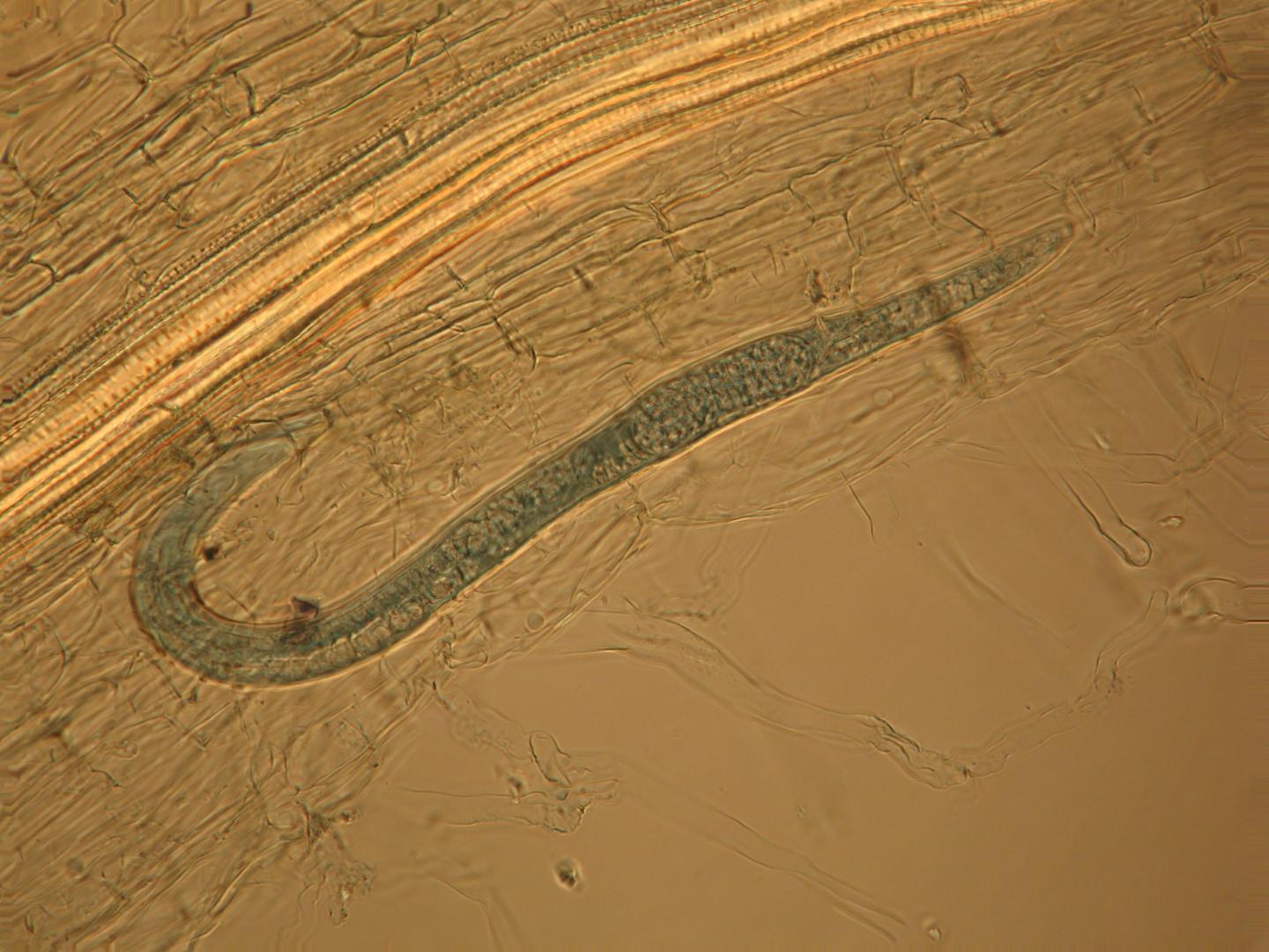 Female Lesion Nematode in White Clover Roots