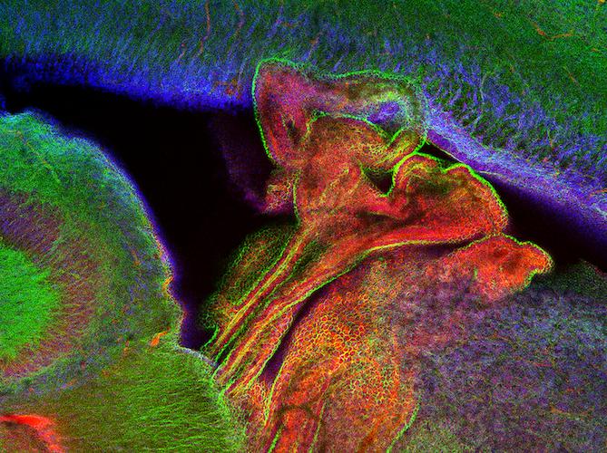 Choroid plexus of mouse neonates