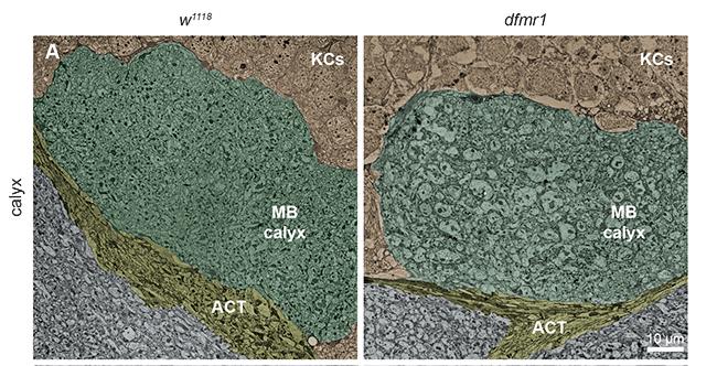 Fragile X Memory-Sensory Neuron Connections