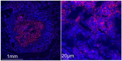 How Damaging Immune Cells Develop during Tuberculosis