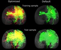 Comparing optimized and default algorithms on training brains and test brains