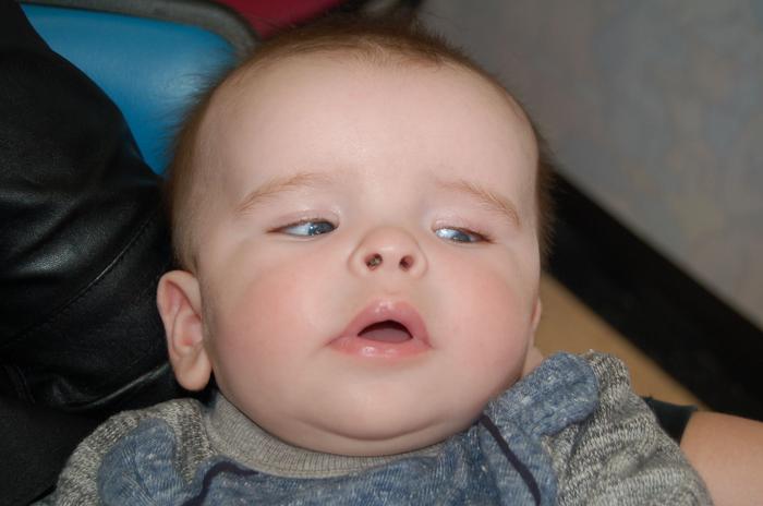 Study subject macrocephaly [IMAGE] EurekAlert! Science News Releases