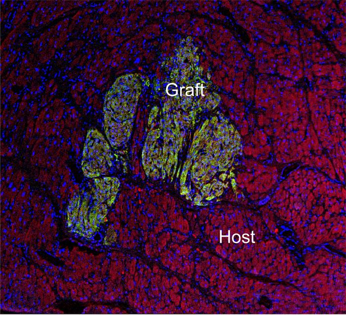 cell graft