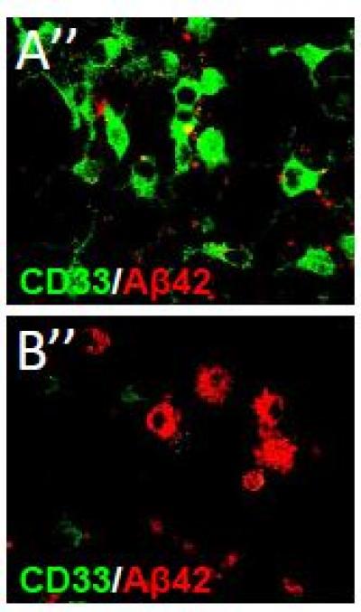 CD33 and Beta-Amyloid in Control and Knockout Mice