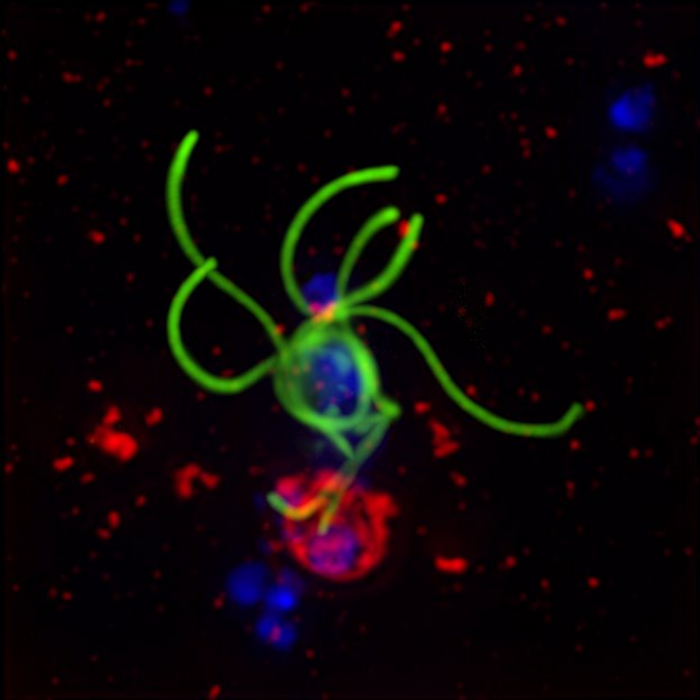 Human red blood cells infected with malaria parasite