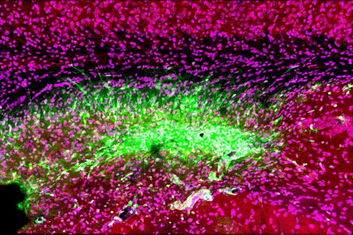 Immune cells attack memory center of brain after stroke