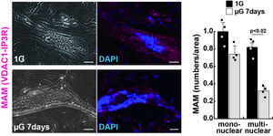 Mitochondria-associated membrane (MAM) number decreases in human muscle cells cultured under microgravity