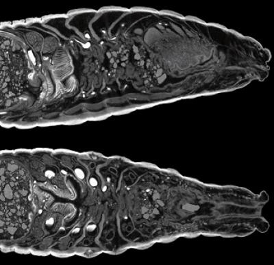 Image from Micro-Computed Tomography of an Earthworm