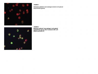 Macrophages' Ability to Absorb Amyloid Beta