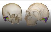 Neanderthal and Modern Human Cranium and Ear