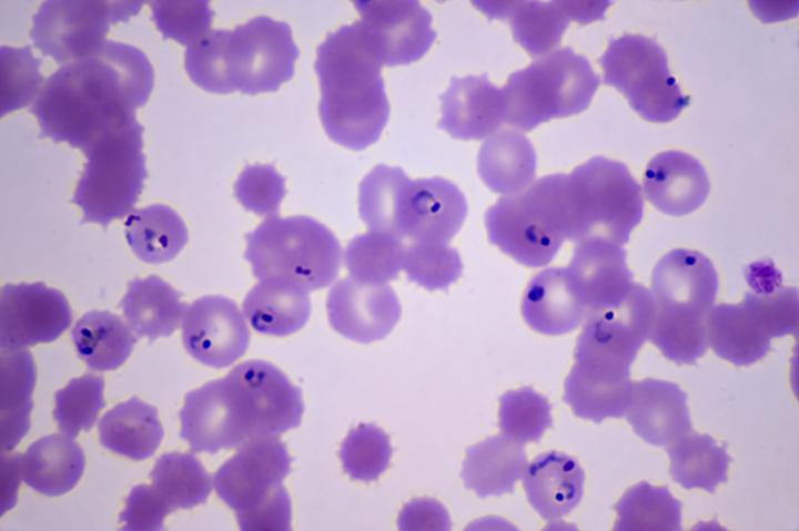 plasmodium falciparum under microscope