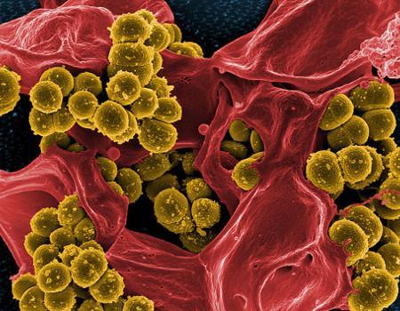 Methicillin-Resistant <i>Staphylococcus aureus</i>