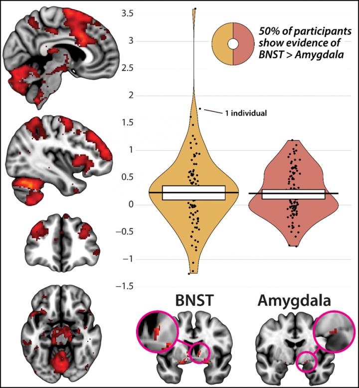 The Overlap Between Fear and Anxiety Brain Circuits
