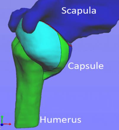 3D model of MR arthrogram