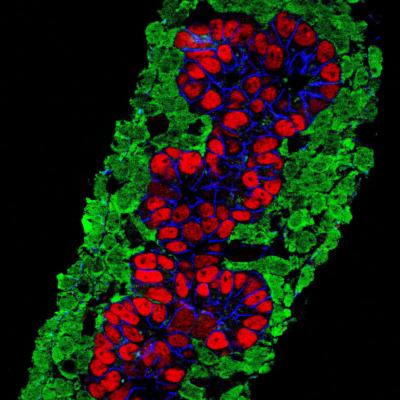 Mesenchyme Surrounds Developing Pancreas