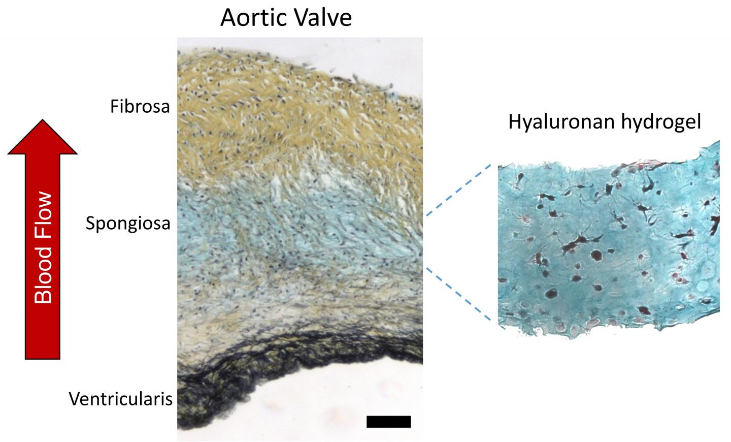 Aortic Valve
