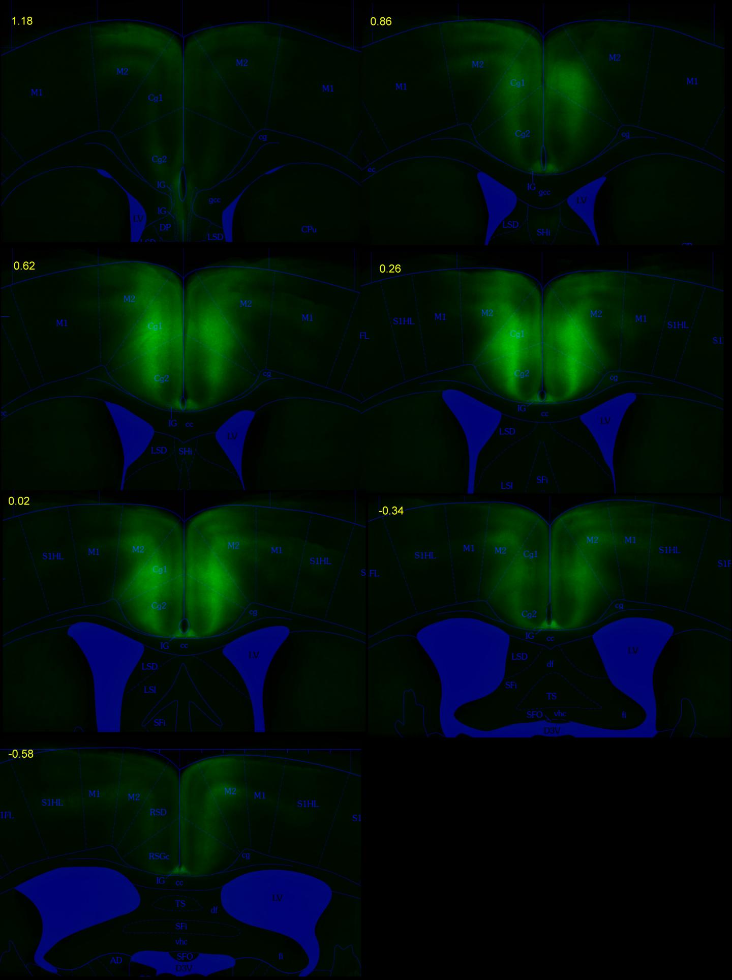 Pinning down how the brain predicts the consequences of choices