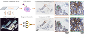 Virtual HER2 staining of unlabeled breast tissue sections using deep learning. Image credit: Ozcan Lab @ UCLA.Figure | Virtual HER2 staining of unlabeled breast tissue sections using deep learning.