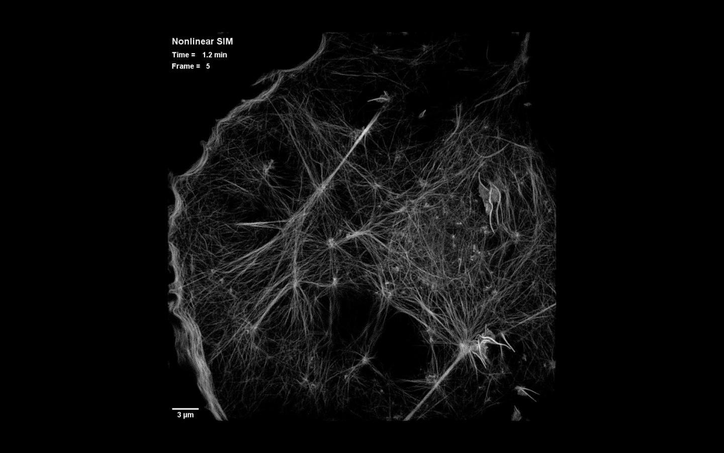 Nonlinear SIM of Cytoskeletal Dynamics