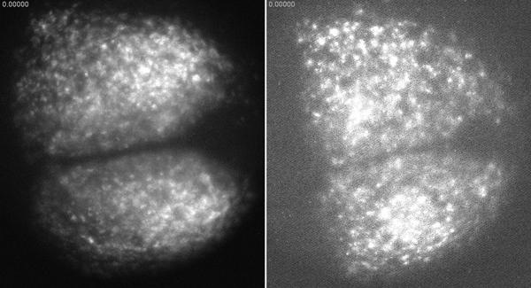 SCN Before and After the Introduction of the Neurotoxin