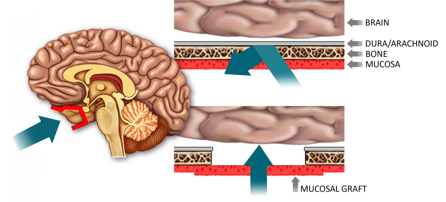 Drug Delivery across Blood-Brain Barrier