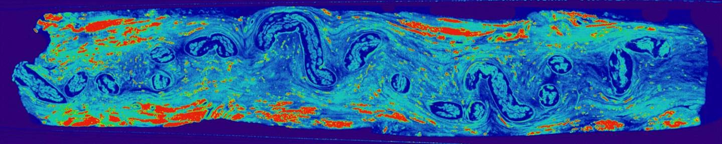 Micro-CT Scan of a Fin Whale VGB Nerve